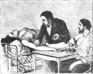 Αυτό οφειλόταν στο ότι το αίμα που χρησιμοποιούσαν ήταν συχνά άλλης ομάδας και οι κανόνες της ασηψίας ήταν άγνωστοι. Έτσι η μετάγγιση λησμονήθηκε για περίπου δύο αιώνες.