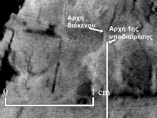 Εικ.2.5: Τομογραφίες από το θραύσμα Β.