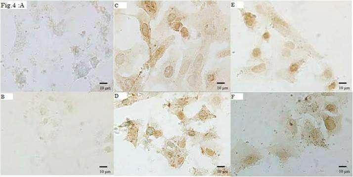 ΔΗΘ. 4: ΑΛΟΟΪΣΟΥΖΚΗΘΖ ΈΘΦΡΑΖ EGFR Δ A549 (ΑΛΩ) ΘΑΗ SKMES (ΘΑΣΩ) ΔΠΗΘΖΙΗΑΘΑ ΘΤΣΣΑΡΑ (METHYLENE GREEN X700).