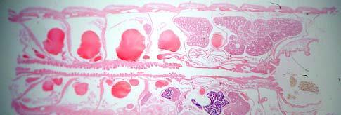 Ολιγόχαιτος: επιμήκης τομή σε εγκεφαλική περιοχή Νευρικό σχοινί Οισοφάγος
