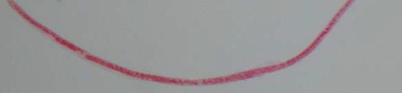 Trichinella spiralis Ωοθήκη Ωαγωγοί