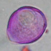 0) ΣΧΗΜΑ: ωοειδές Cercis silicuastrum ΠΕΡΙΟΔΟΣ ΑΝΘΟΦΟΡΙΑΣ: Μάρτιος -