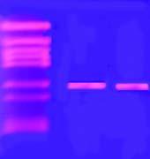 Αποτελέσματα Οι συνθήκες που χρησιμοποιήθηκαν για τις δύο συνεχόμενες PCR αντιδράσεις ήταν οι εξής: αποδιάταξης 95 C, 2 min αποδιάταξης 95 C, 30 s υβριδοποίησης 48 C, 30 s πολυµερισµού 72 C, 50 s