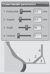 ΧΡΉΣΗ Παράμετροι ορίου στο λογισμικό CAD Στο Ceramill Zolid Preshades πρέπει να προσέχετε να έχουν επαρκές πάχος τα πάχη των άκρων. Προτεινόμενες τιμές: _1. Πάχος άκρου (Horizontal): 0,2 mm _2.