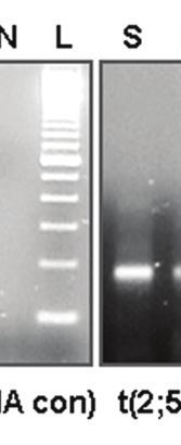 L= L κλίμακα (ladder) ανα α 100bp DN NA. Α. Β. κόνα 11.