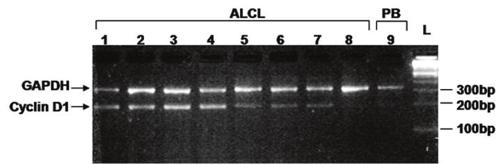 duplex RT-PCR για την cyclin D1.