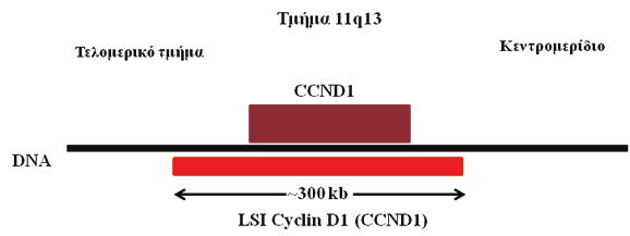 Για τη μέθοδο FISH χρησιμοποιήθηκε το εμπορικά διαθέσιμο σύμπλεγμα ιχνηθετών LSI TM Cyclin D1 (11q13) Spectrum Orange/CEP11 Spectrum Green Probe (Vysis).