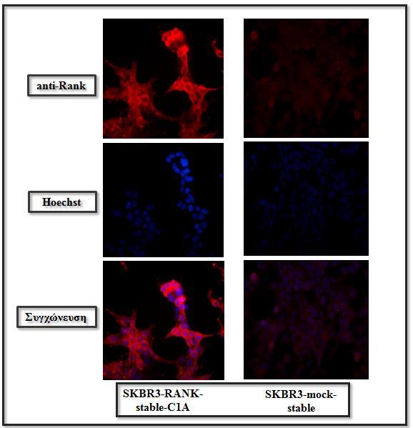 Εικόνα 20: Κατασκευή σταθερά διαμολυσμένων SKBR3 με πλασμιδιακό φορέα (pcdna3.1) που φέρει κλωνοποιημένο το γονίδιο TNFRSF11A. Η σωστή κυτταρική εντόπιση επιβεβαιώνεται με τη χρήση ανοσοφθορισμού.