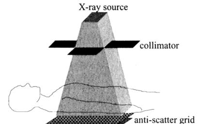 Προβολική Απεικόνιση Ακτίνων X (ακτινογράφηση) φιλµ (δισ-διάστατη αναλογική