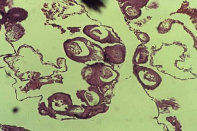 Τον Ιούνιο τα ωοκύτταρα καθώς αναπτύσσονται, περιβάλλονται από ένα στρώµα επιµήκων-επίπεδων κυττάρων που δηµιουργούν τα ωοθυλάκια.