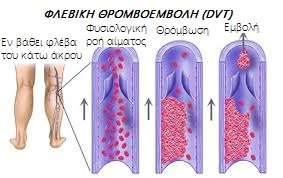 πρώτο επεισόδιο, η φλεβική θρομβοεμβολή έχει επαναληψημότητα.