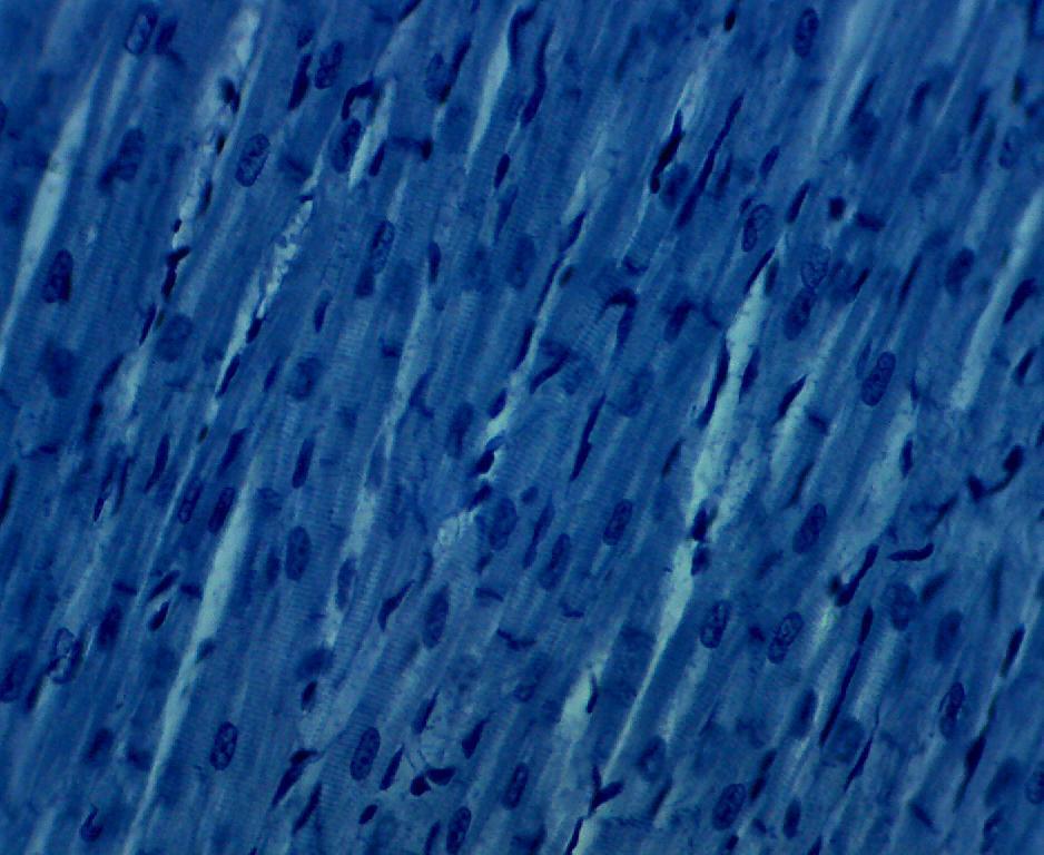 Καρδιακά κύτταρα μεγαλωμένα κατά 400 φορές στο οπτικό μικροσκόπιο Οι πυρήνες φαίνονται