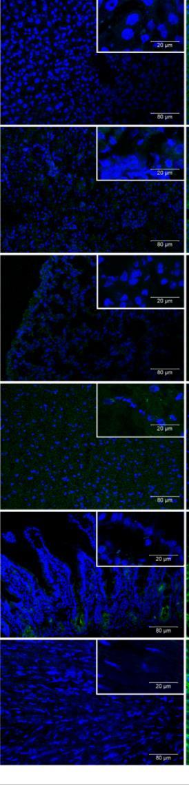 τα κύτταρα από λεμφαδένες ήταν αρνητικά. Α 1 2 3 Εικόνα 18. Κυτταρική διείσδυση της IVIg in vivo.