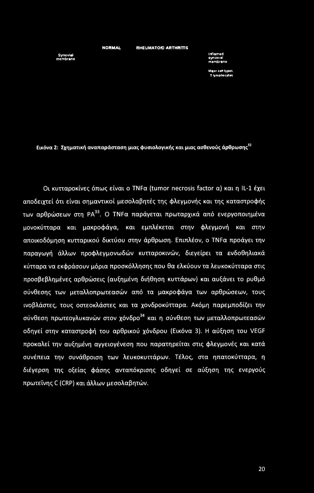 Ο TNFa παράγεται πρωταρχικά από ενεργοποιημένα μονοκύτταρα και μακροφάγα, και εμπλέκεται στην φλεγμονή και στην αποικοδόμηση κυτταρικού δικτύου στην άρθρωση.