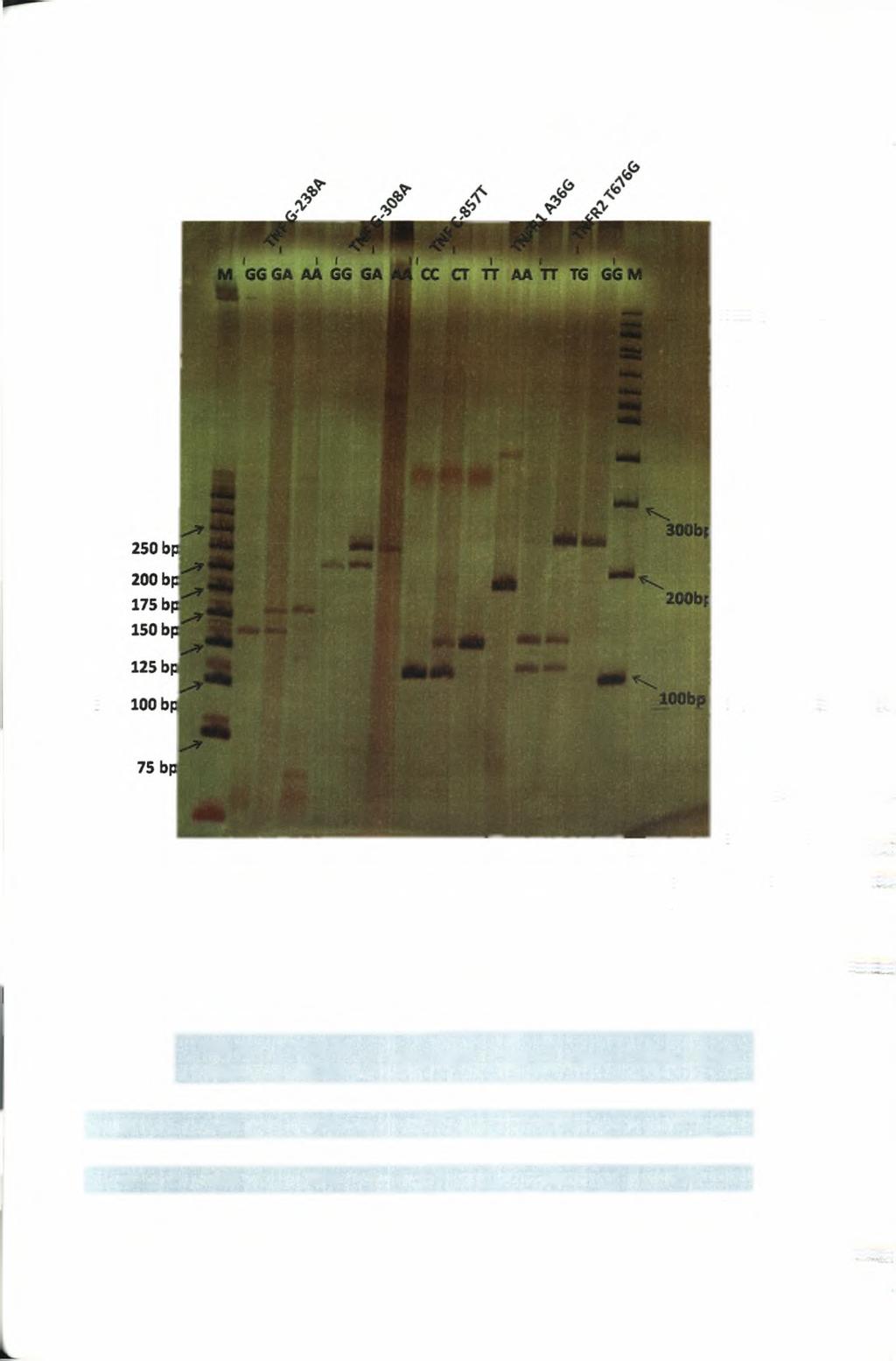 Εικόνα 22: RFLP - PAGE γονοτύπηση των υπό μελέτη