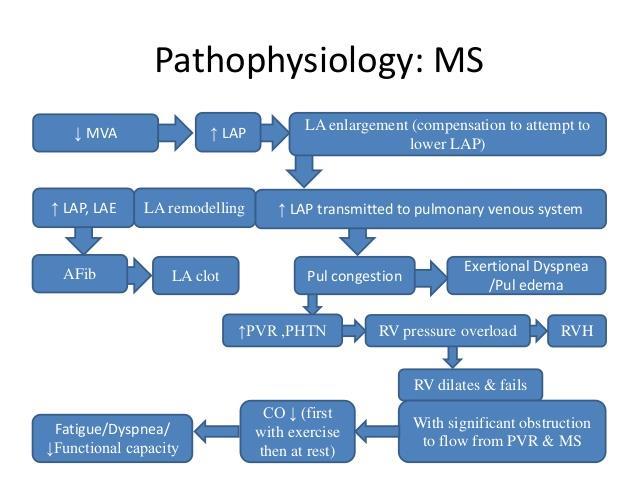 Postoperative outcome is shown for mitral stenosis patients with pulmonary hypertension.
