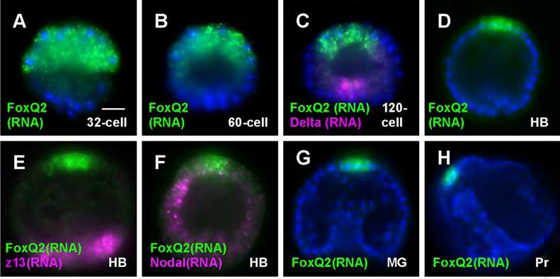 (F) foxq2 and nodal (oral ectoderm) mrnas, hatching blastula.(g and H) foxq2 mrna, midgastrula (MG) and prism (Pr).