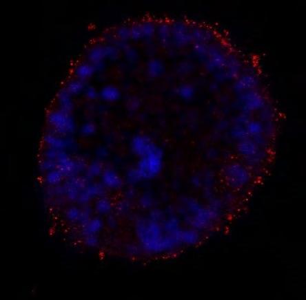 Εικόνα 32: Ενεμένα έμβρυα με αντινοηματικό CoupTF RNA (Knocked down regulation ) Ώστοσο παρότι είχαμε μια