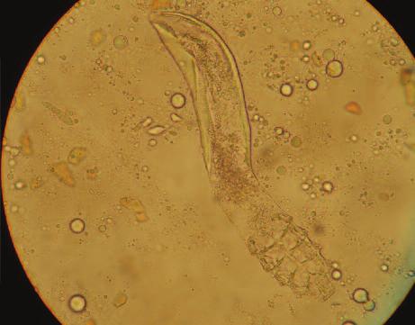 ΑΝΘΡΩΠΙΝΑ ΠΑΡΑΣΙΤΑ DEMODEX, ΔΕΜΟΔΗΚΩΣΗ θόσωμα (στόμα του ακάρεος) που διαθέτει αιχμηρό άκρο, με τη βοήθεια του οποίου το παράσιτο εξασφαλίζει την τροφή του με δερματικά κύτταρα, ορμόνες και σμήγμα