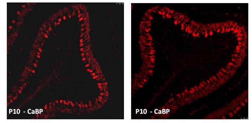 77 TAG-1 (Axonal glycoprotein TAG-1): Μόριο συνάφειας που εκφράζεται από τα κοκκώδη κύτταρα της παρεγκεφαλίδας, αφού ολοκληρώσουν τις μιτωτικές τους διαιρέσεις στη στοιβάδα EGL και πριν ξεκινήσουν τη