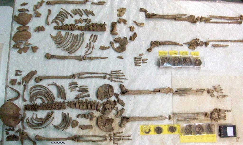 Στη συνέχεια παρουσιάζονται αναλυτικά οι τεχνικές και οι μετρήσεις που πραγματοποιήθηκαν για τον ακριβή προσδιορισμό του φύλου για κάθε σκελετό. Εικόνα 3.1: Τα οστά από τους δύο τάφους.