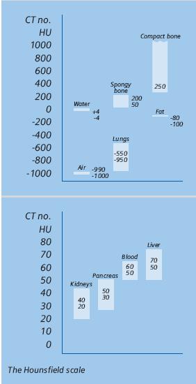 clinical systems, the range of CT number is limited by the number of bits used to represent the data. For example, in a 12 bit system the CT numbers range from -1024 to 3071 (2 12 values).