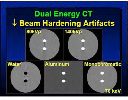 Thus, the use of relatively high energies diminishes the diagnostic value of the resultant images.