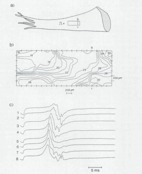 Ινωση και Τάση στους ΘΜ DAEDs trigger reentry VT Wilde et al.