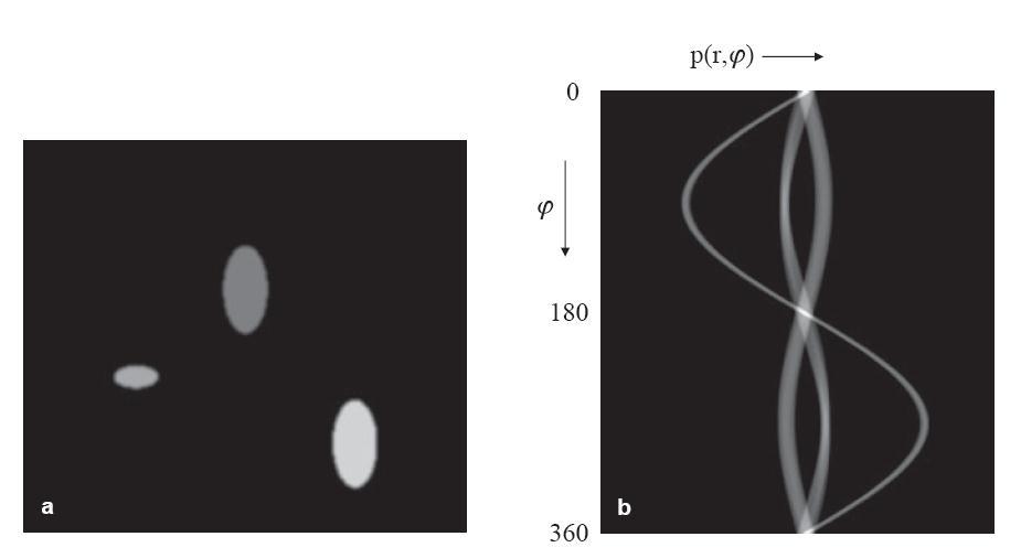 COMPUTED Φ-RAY TOMOGRAPHY Γιατύ το ημιτονόγραμμα b (δεξιϊ) δεν