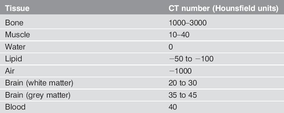 ΑΡΙΘΜΟ CT (Haunsfield Number)