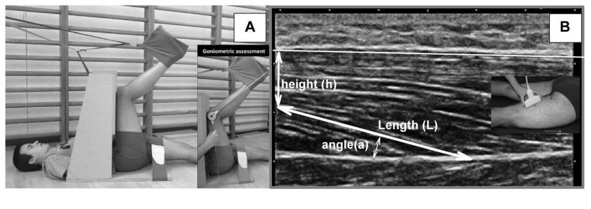 Shear elastic modulus Le Sant et al.