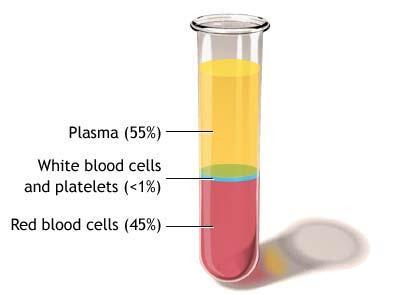 Το αίμα αποτελείται από: 95% Water 5% Proteins - Albumin - Globulins - Fibrinogen