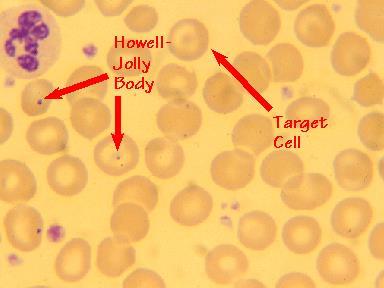 Σωμάτια Howell-Jolly