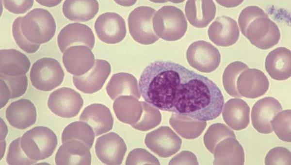 Μονοκύτταρο Τα μεγαλύτερα λευκά αιμοσφαίρια Νεφροειδής πυρήνας