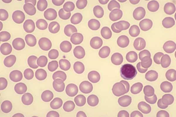 Λεμφοκύτταρα Τα μικρότερα λευκά αιμοσφαίρια Στρογγυλός/οβάλ πυρήνας Ώριμη χρωματίνη Ελάχιστο γαλαζωπό κυτταρόπλασμα χωρίς