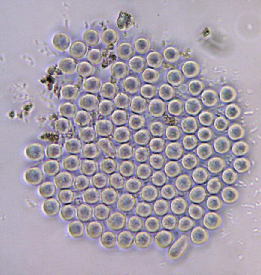 Hematopoietic stem cells 1 / 25 000-100 000 of bone marrow cells Blood, 15 Jan 2004