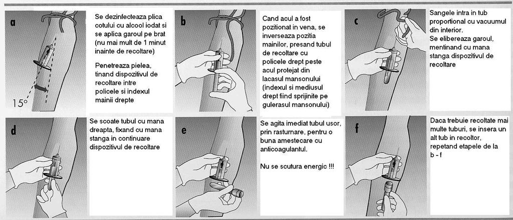 Spitalul Clinic de Urgenţă Tg.Mureş Laborator de Analize Medicale Central MANUALUL RECOLTARII 1.2.2 Tehnica recoltării cu sistemul vacutainer (Fig.
