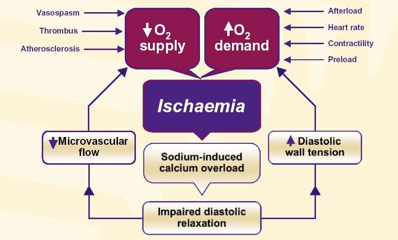 Angina pathophysiology Oxygen supply and demand mismatch Chaitman BR.