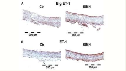 Chronic nitrate use causes endothelial dysfunction