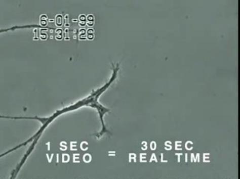 Αριστερά άνω. Η φυσιολογική εξέλιξη νευρώνων όπως εμφανίζεται σε βίντεο που δόθηκε στη δημοσιότητα από ερευνητές τού πανεπιστημίου Κάλγκαρι στο Τορόντο τού Καναδά.