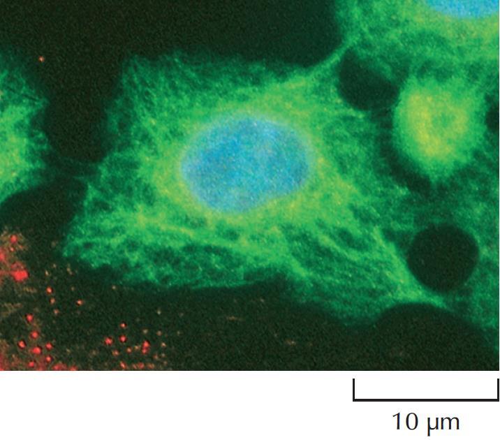 Tα ενδιάμεσα ινίδια σχηματίζουν δίκτυα Φωτογραφία ηλεκτρονικού μικροσκοπίου που δείχνει επιθηλιακά κύτταρα τα οποία έχουν σημανθεί με φθορίζοντα αντισώματα έναντι της