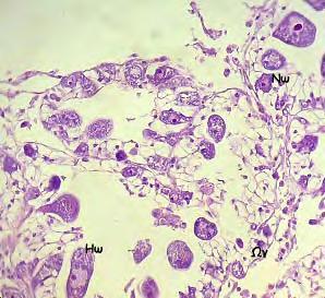 ιακρίνονται ωοθυλάκια µε παχιά τοιχώµατα που φέρουν ωογόνια (Ωγ) και νεαρά ωοκύτταρα (Νω).
