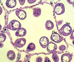 ιακρίνονται πολυάριθµα ωοθυλάκια µε λεπτά τοιχώµατα που φέρουν στοιβαγµένα κυρίως ώριµα ωοκύτταρα.