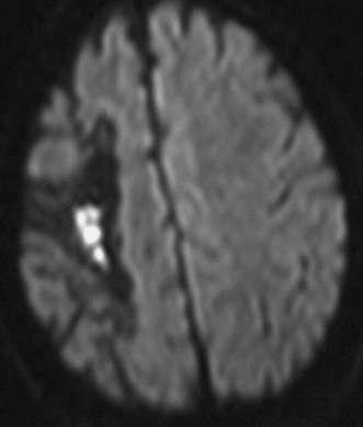 MRI ΠΡΖ ΓΓ. ΗΠΣΑΗΚΗΘΝ ΑΔΔ ΓΓ.