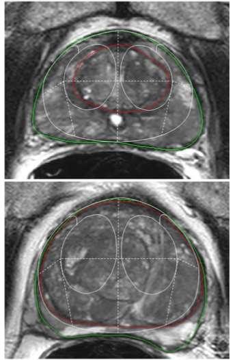 The zonal anatomy of