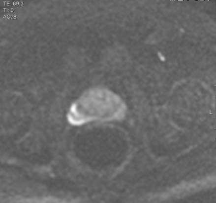 case of a positive diagnosis