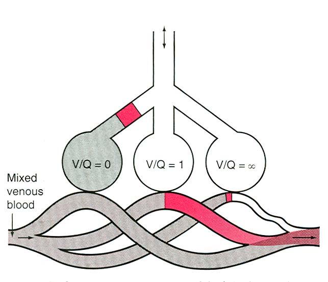 3 compartment model