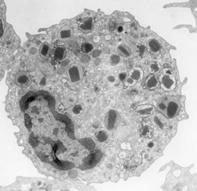 PRIMARNE GRANULE -