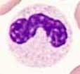 neutrophils) Ο πυρήνας μοιάζει με
