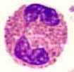 ΗΩΣΙΝΟΦΙΛΑ (eosinophils) Εμφάνιση: Τα ηωσινόφιλα κοκκιοκύτταρα έχουν διάμετρο 12-17 μm, είναι στρόγγυλα και πολύ λίγο μεγαλύτερα από τα ουδετερόφιλα.